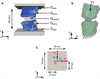 In silico medical device testing of anatomically and mechanically conforming patient-specific spinal fusion cages designed by full-scale topology optimisation